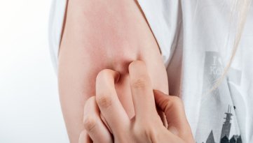 Puntura di zecca: come riconoscerle e intervenire