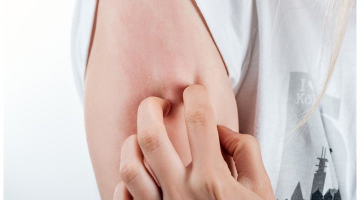 Puntura di zecca: come riconoscerle e intervenire