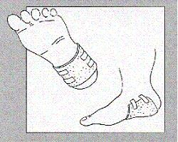 Ligasano 24X16X1CM 10PZ